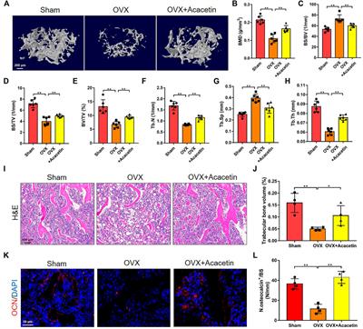 Acacetin Prevents Bone Loss by Disrupting Osteoclast Formation and Promoting Type H Vessel Formation in Ovariectomy-Induced Osteoporosis